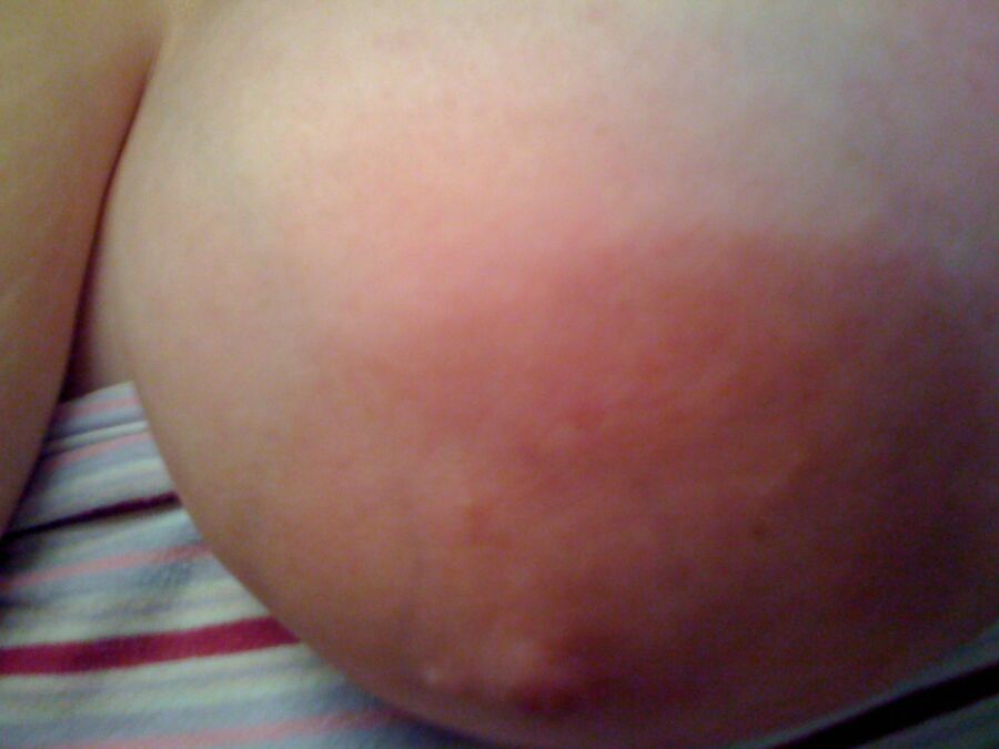 udders ready to get milked :)  1 of 5 pics